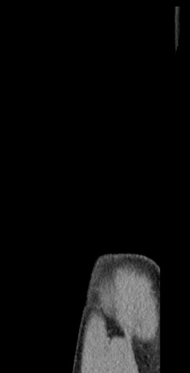 Schwarze und weiße MRI-Aufnahme eines Mannes, die einen detaillierten Blick auf das Gehirn zeigt.